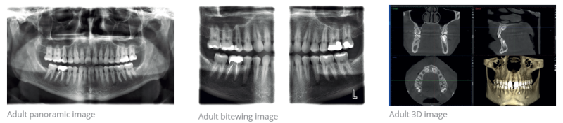 digital xrays