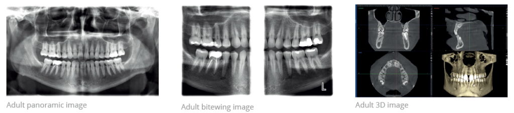 digital xrays