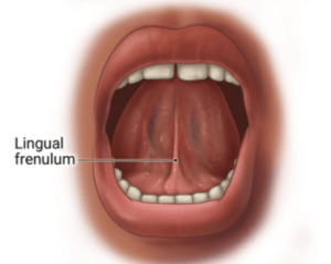Illustration of an open mouth highlighting the lingual frenulum.