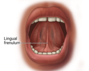 Illustration of an open mouth highlighting the lingual frenulum.