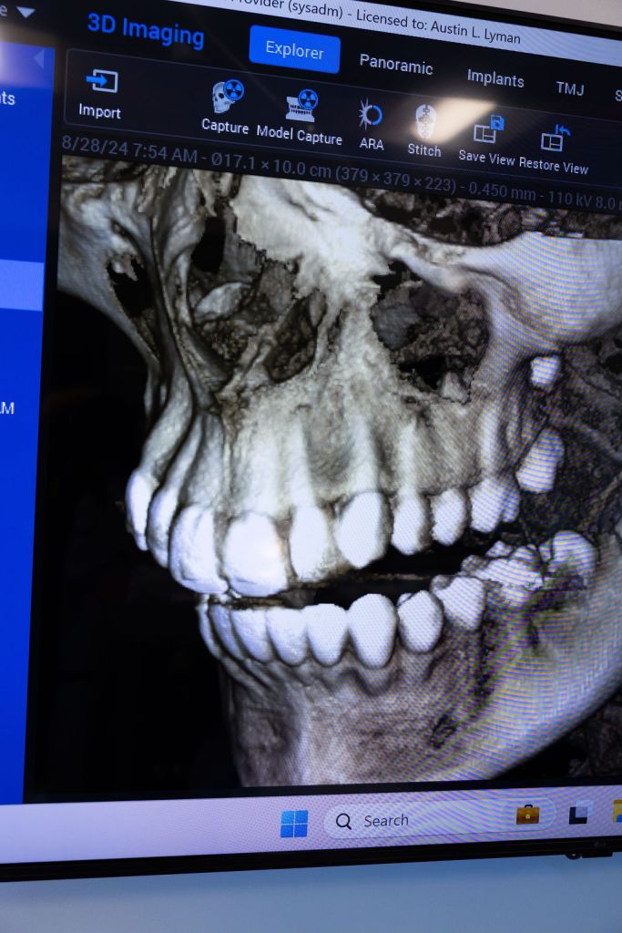 X-ray